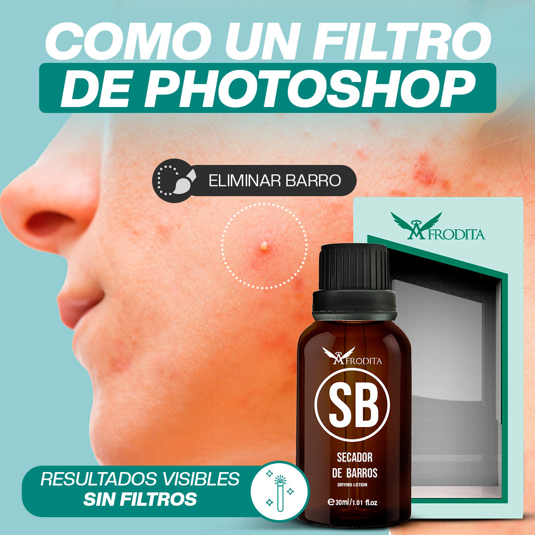 Sérum Secador de Barros | Tratamiento Anti-Acné con Zinc