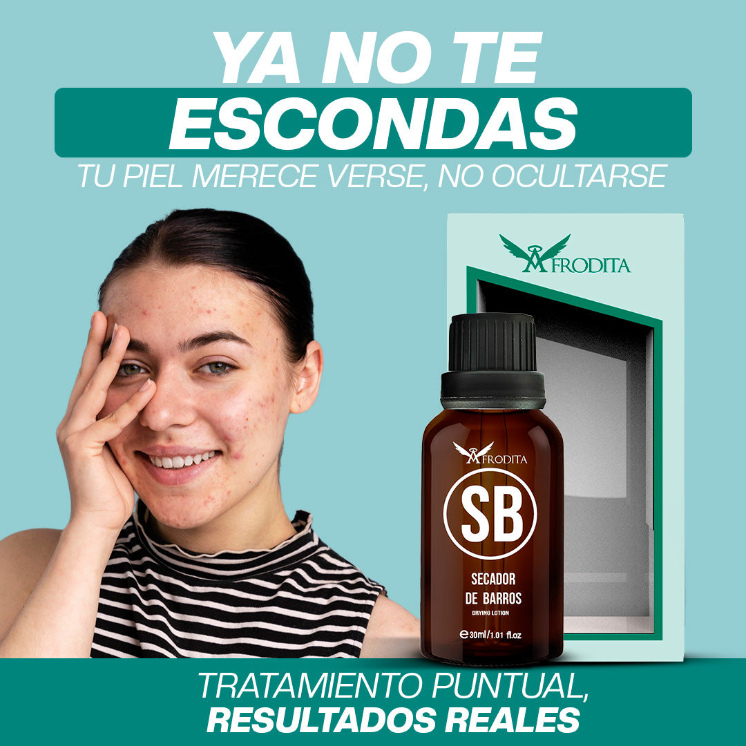 Sérum Secador de Barros | Tratamiento Anti-Acné con Zinc